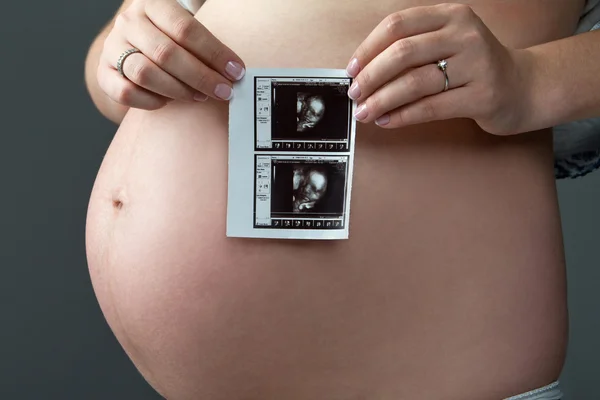 Pregnant woman holding in hands ultrasound scan