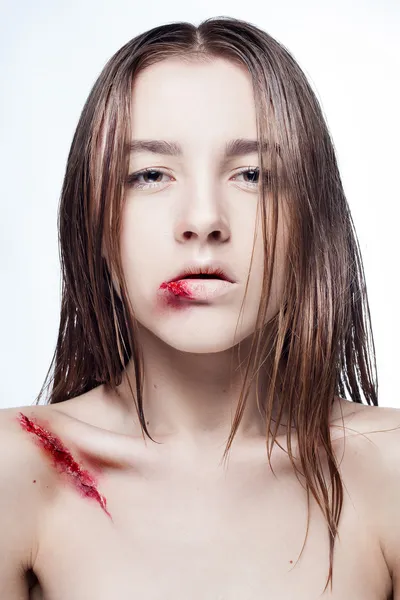 Girl with a scar on face and shoulder