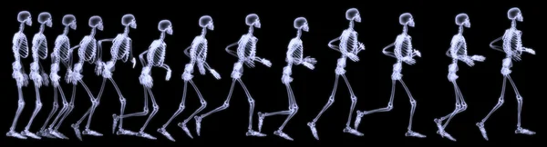 X-Ray radiography of human body (skeleton)