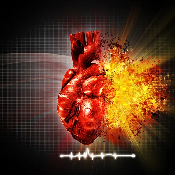 Heart attack — Stock Photo, Image