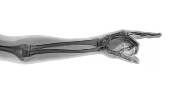 Указание на рентгеновскую руку
