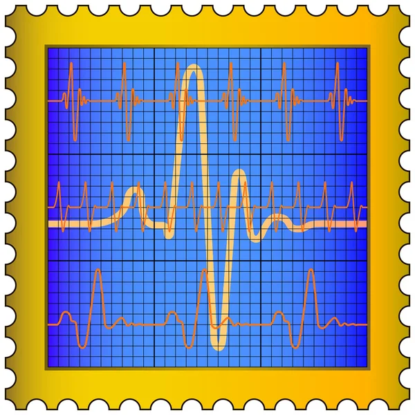 Cardiogram op postzegel — Stockvector