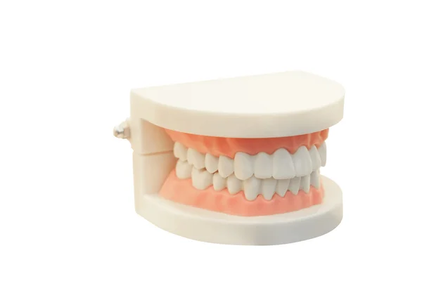 La imagen de las prótesis dentales —  Fotos de Stock