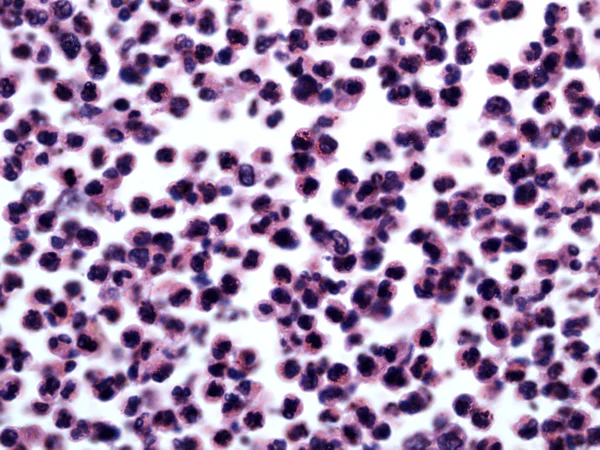 Witte bloedcellen van een mens Stockfoto