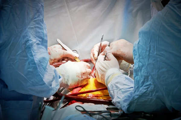 Surgery operation — Stock Photo, Image