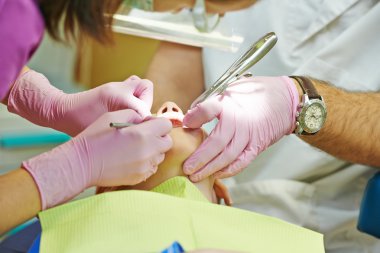 tandheelkundige indiening van kind tand door ultraviolet licht