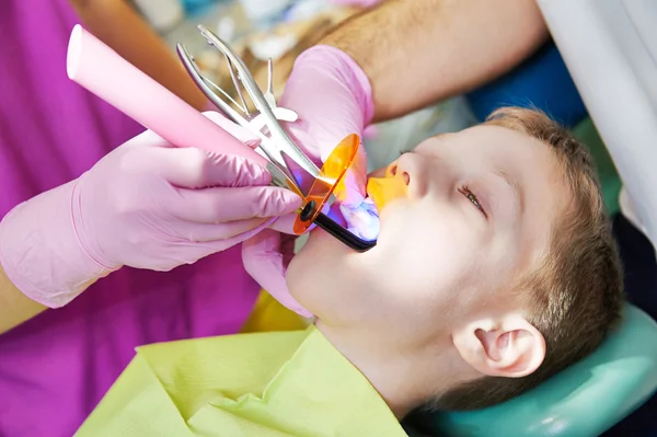 Dental filing of child tooth by ultraviolet light — Stock Photo, Image