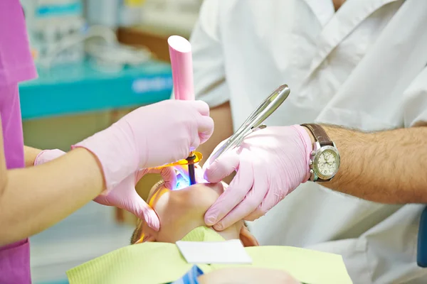 Dental filing of child tooth by ultraviolet light — Stock Photo, Image