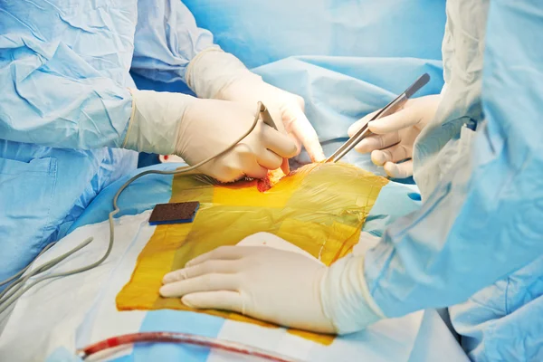 Cardiac surgery operation — Stock Photo, Image