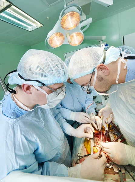Equipo de cirujanos en cirugía cardíaca — Foto de Stock