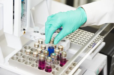 Torpido gözünde flask testi eczane Laboratuvarı ile el