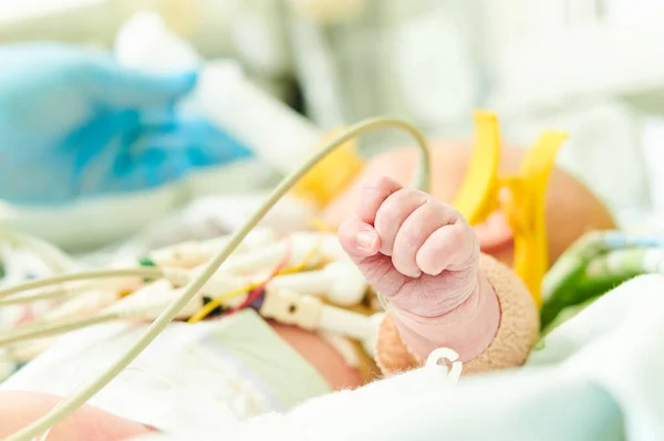 Neonato in incubatrice presso il centro di rianimazione neonatale — Foto Stock