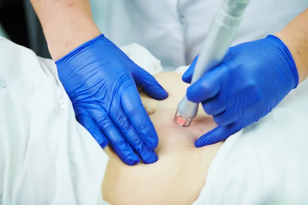 Kosmetische Laserchirurgie und Hauterneuerung in der Dermatologie — Stockfoto