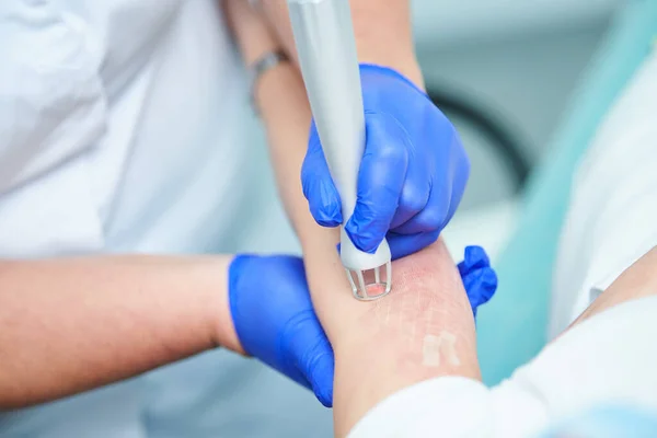 Kosmetische Laserchirurgie und Hauterneuerung in der Dermatologie — Stockfoto