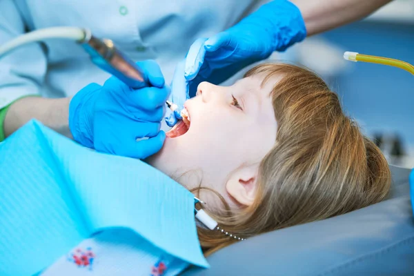 Odontología infantil. Liitle girl un examen de dentista, limpieza de dientes y tratamiento. —  Fotos de Stock