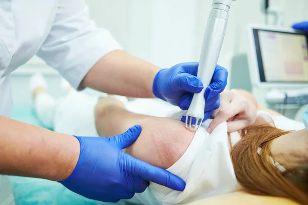 Laser Estetisk Kosmetisk Dermatologi Revidering Och Behandling Ärr Med Koldioxid — Stockfoto