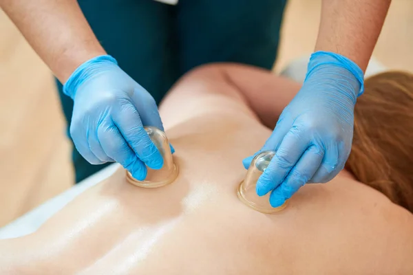 Fisioterapia Coppettazione Medici Mani Guanti Con Bicchieri Plastica Eseguire Massaggi — Foto Stock