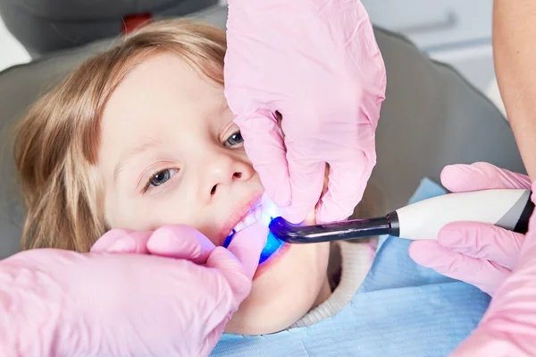 儿童牙科 利特尔女孩的牙医检查 专业的预防牙齿清洁和治疗 医生手拿着紫外线灯 — 图库照片