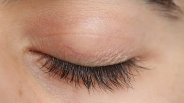 yanıp sönen adamı göz