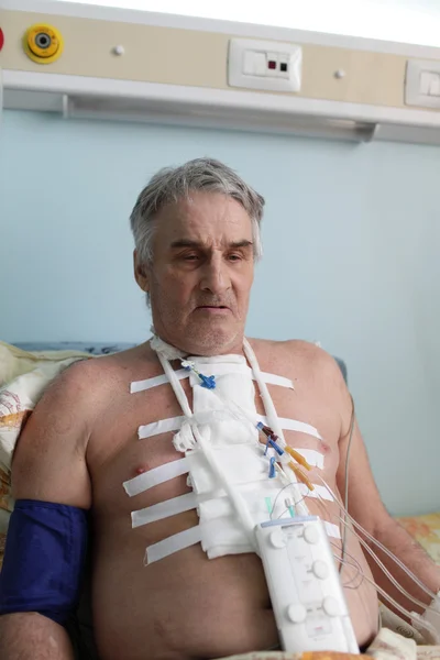 Человек с кардиостимулятором — стоковое фото