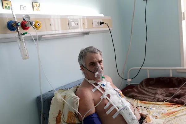 Paziente con maschera di ossigeno — Foto Stock