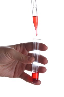 test tüpleri ve damlalıklı