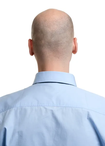 Adulto homem careca cabeça traseira vista — Fotografia de Stock
