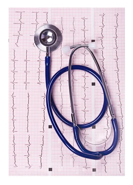 Stethoscope on the cardiogram — Stock Photo, Image