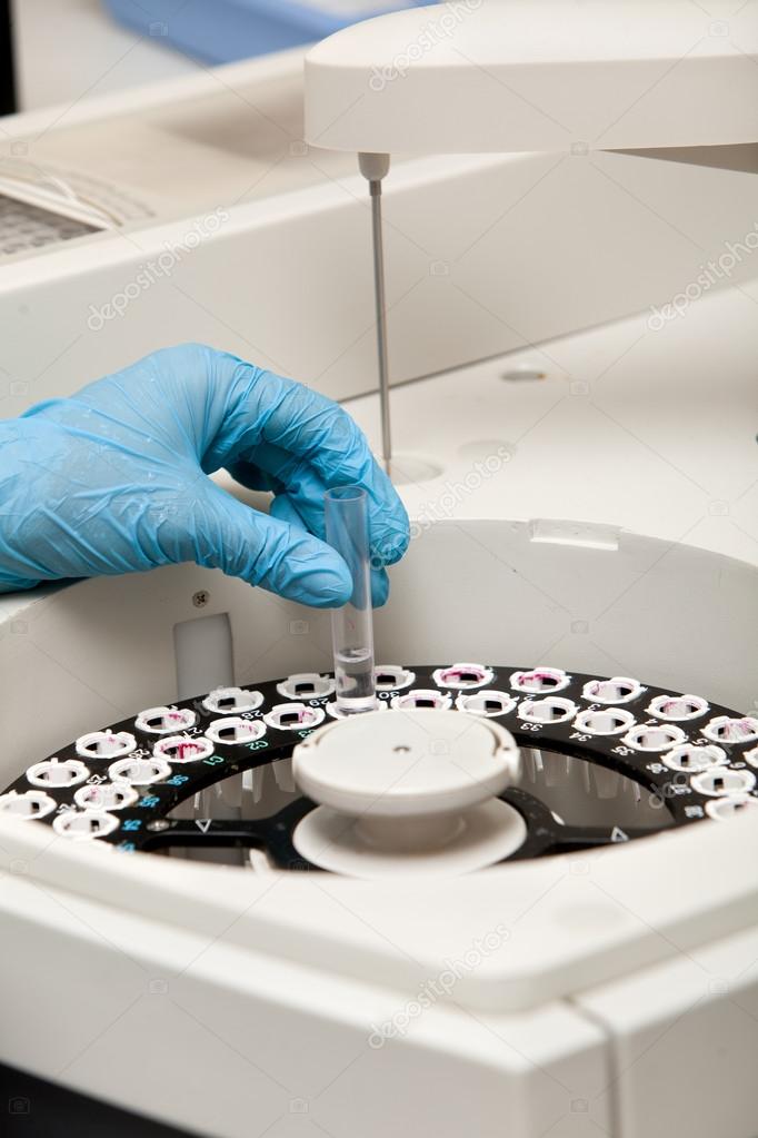 Modern robotical machine for centrifuge blood and urine testing