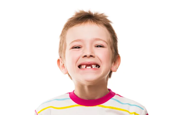 Första barnet mjölk eller tillfälliga tänder faller ut — Stockfoto