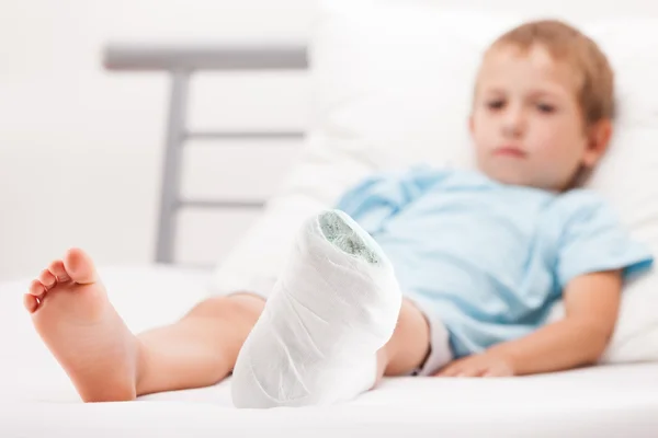 Kis gyerek fiú gipszpólya sarok lábtörést vagy br — Stock Fotó