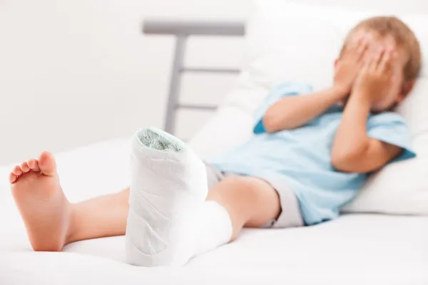 Niño pequeño con vendaje de yeso en la fractura del talón de la pierna o br — Foto de Stock