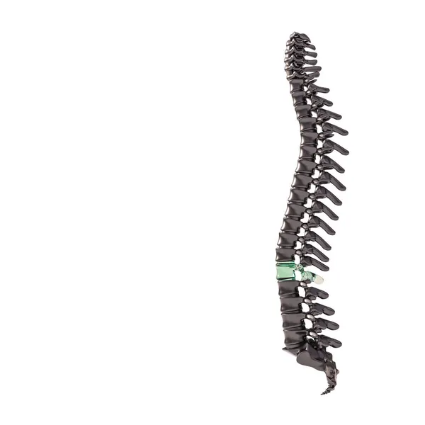 Coluna Preta Com Vértebras Vidro Conceito Fragilidade Renderização — Fotografia de Stock