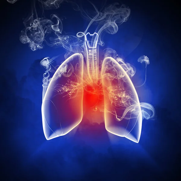 Schematic illustration of human lungs — Stock Photo, Image