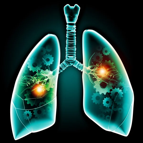 Pulmones humanos — Foto de Stock