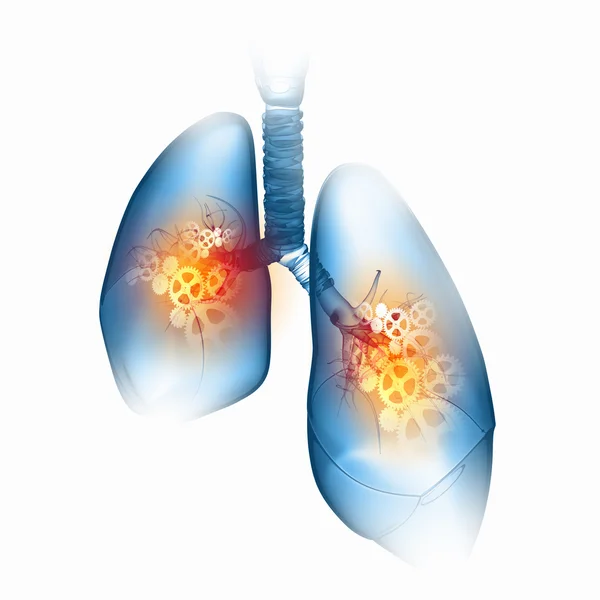 Human lungs — Stock Photo, Image