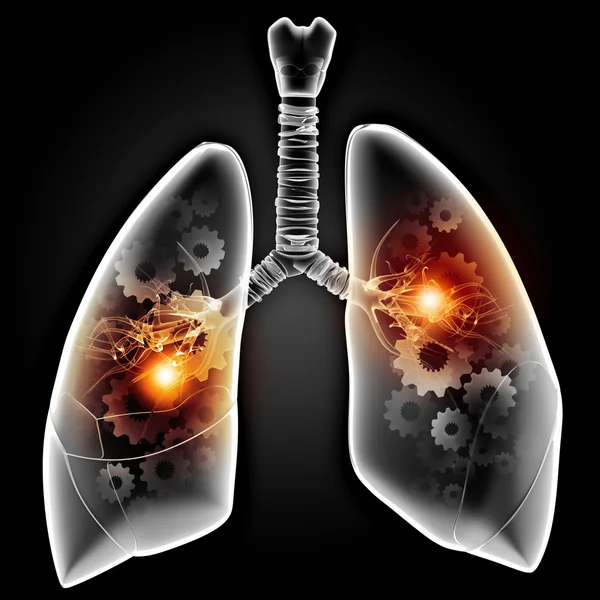 Pulmones humanos — Foto de Stock