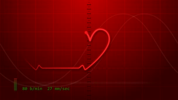 ECG - Eletrocardiograma — Vídeo de Stock