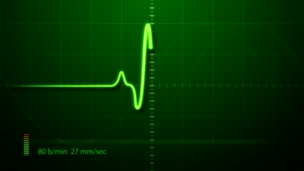 ECG - Elettrocardiogramma — Video Stock