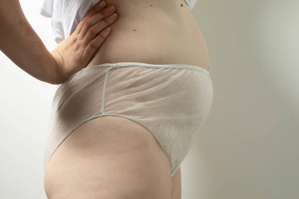 Dámské popoporodní břicho v jednorázových kalhotkách, hygiena — Stock fotografie