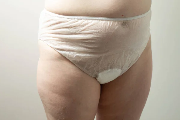 Female postpartum belly in disposable underpants, hygiene — Stockfoto