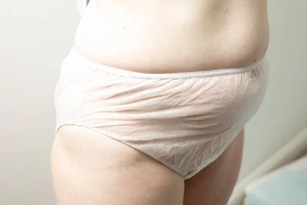 Female postpartum belly in disposable underpants, concept of postpartum recovery