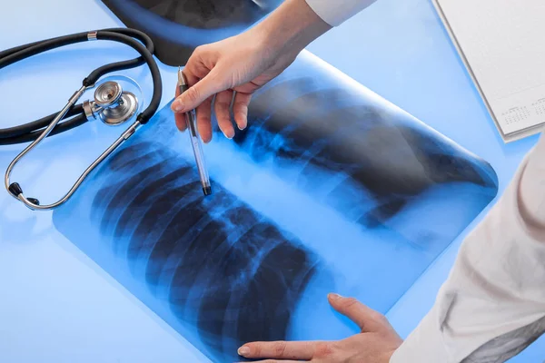 Médecin Examine Image Radiographique Des Poumons Couchés Sur Table Lumineuse — Photo