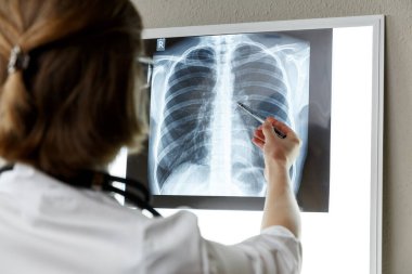 Pulmonologist therapist examining an x-ray of lungs. Health care and medical insurance concept