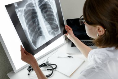 Pulmonolog akciğer röntgenini inceliyor. Sağlık ve sağlık sigortası kavramı