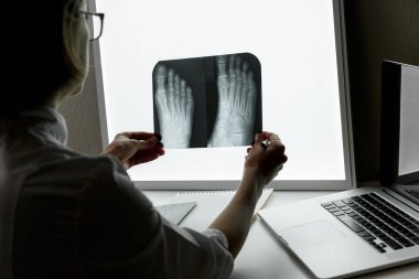 Orthopedic surgeon examining an x-ray of the foot. Health care and medical insurance concept
