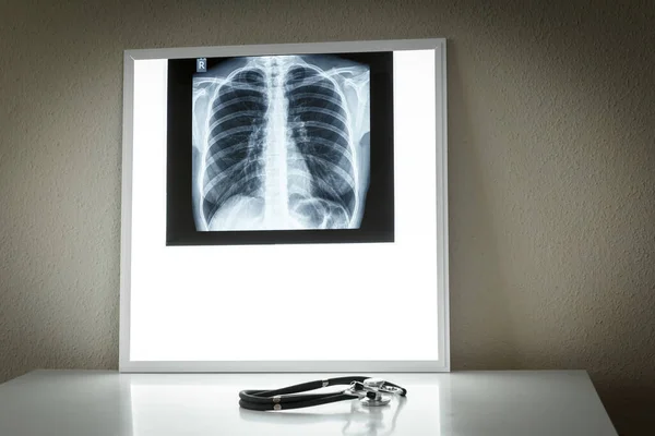 Pulmonolojik Kabine Akciğer Röntgeni Sağlık Sağlık Sigortası Kavramı — Stok fotoğraf