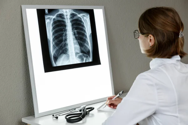 Terapeuta Pneumologista Examinar Uma Radiografia Dos Pulmões Conceito Cuidados Saúde — Fotografia de Stock