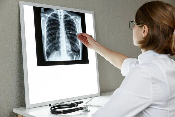 Terapeuta Pneumologista Examinar Uma Radiografia Dos Pulmões Conceito Cuidados Saúde — Fotografia de Stock