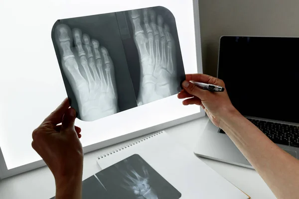 Cirujano Ortopédico Examinando Una Radiografía Del Pie Concepto Atención Médica —  Fotos de Stock